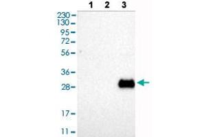 Western blot analysis of Lane 1: RT-4 cells, Lane 2: U-251MG sp cells, Lane 3: Human plasma (IgG/HSA depleted) with FGFR2 polyclonal antibody . (FGFR2 antibody  (AA 38-122))