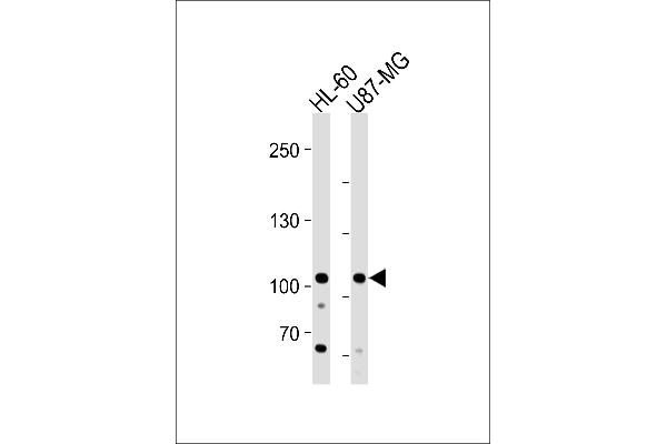 MORC3 Antikörper  (AA 634-663)