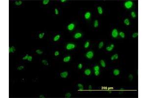 Immunofluorescence of monoclonal antibody to TRIM36 on HeLa cell. (TRIM36 antibody  (AA 391-499))