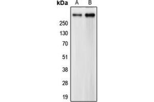 Western blot analysis of CEP290 expression in HeLa (A), CCRFCEM (B) whole cell lysates.