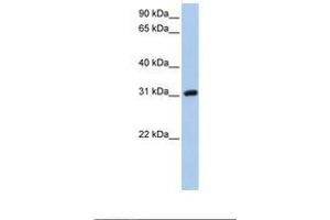 Dickkopf-Like 1 (DKKL1) (C-Term) antibody