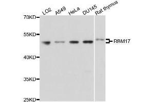 Western blot analysis of extracts of various cell lines, using RBM17 antibody. (RBM17 antibody  (AA 1-240))