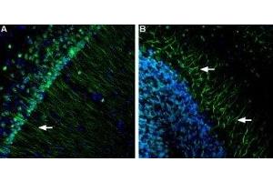 Expression of Presenilin-1 in mouse brain - Immunohistochemical staining of mouse hippocampus and mouse cerebellum using Anti-Presenilin-1 Antibody (ABIN7043552, ABIN7044524 and ABIN7044525), (1:600). (Presenilin 1 antibody  (AA 345-359))