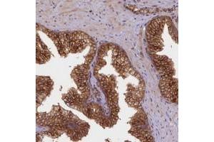 Immunohistochemical staining of human prostate with UFM1 polyclonal antibody  shows strong cytoplasmic positivity in glandular cells.