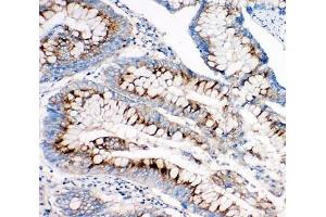 Immunohistochemistry (IHC) image for anti-Insulin-Like Growth Factor 2 Receptor (IGF2R) (C-Term) antibody (ABIN3031349)