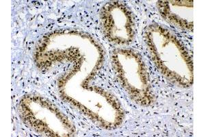 IHC analysis of XRCC1 using anti-XRCC1 antibody . (XRCC1 antibody  (AA 538-633))