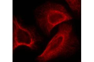 Immunofluorescence staining of methanol-fixed Hela cells showing cytoplasmic, centrosomal and nuclear staining using p70 S6 Kinase(Phospho-Ser424) Antibody. (RPS6KB1 antibody  (pSer424))
