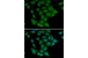 Immunofluorescence analysis of U20S cell using CAMK1 antibody.