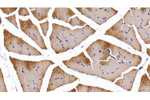 Detection of TNNI2 in Rat Skeletal muscle Tissue using Polyclonal Antibody to Troponin I Type 2, Fast Skeletal (TNNI2) (TNNI2 antibody  (AA 1-182))