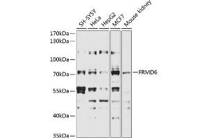 Western blot analysis of extracts of various cell lines, using FRMD6 antibody (ABIN6132194, ABIN6140773, ABIN6140774 and ABIN6225347) at 1:1000 dilution.
