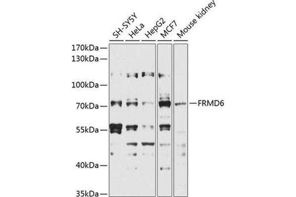 FRMD6 抗体  (AA 405-614)