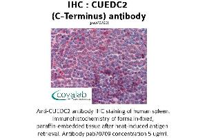 Image no. 2 for anti-CUE Domain Containing 2 (CUEDC2) (C-Term) antibody (ABIN1733372)
