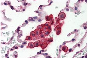 Human Lung (formalin-fixed, paraffin-embedded) stained with CLU antibody ABIN364331 at 10 ug/ml followed by biotinylated anti-mouse IgG secondary antibody ABIN481714, alkaline phosphatase-streptavidin and chromogen. (Clusterin antibody  (AA 1-333))
