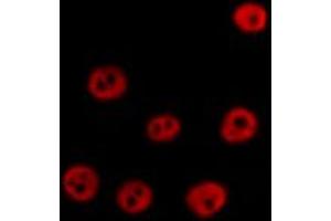 ABIN6267631 staining HT29 by IF/ICC. (PRKAA1 antibody  (pSer486))