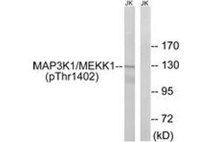 Western blot analysis of extracts from Jurkat cells, using MAP3K1 (Phospho-Thr1402) Antibody. (MAP3K1 antibody  (pThr1402))