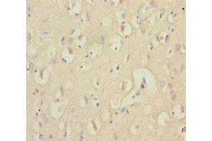 Immunohistochemistry of paraffin-embedded human brain tissue using ABIN7151538 at dilution of 1:100 (EEF1A2 antibody  (AA 184-463))