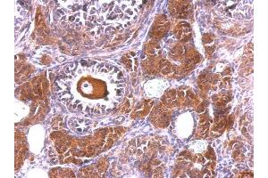 IHC-P Image NLK antibody [N3C3] detects NLK protein at cytosol and nucleus on mouse ovary by immunohistochemical analysis. (Nemo-Like Kinase antibody)
