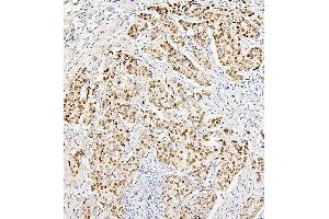 IHC analysis of H1F0 using anti-H1F0 antibody (ABIN7600521). (Histone H1 antibody  (AA 20-159))