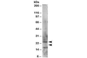 Western blot testing of HeLa lysate with RAB2 antibody at 1ug/ml. (RAB2A antibody)