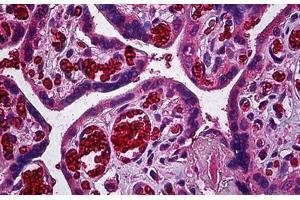Human Placenta, Trophoblast: Formalin-Fixed, Paraffin-Embedded (FFPE) (ERBB3 antibody  (AA 21-332))