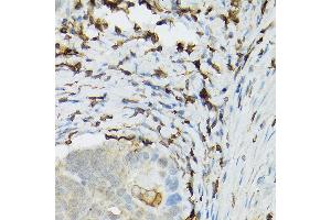 Immunohistochemistry (IHC) image for anti-Toll-Like Receptor 1 (TLR1) (AA 30-290) antibody (ABIN3023655)