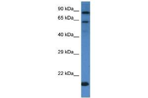 Western Blotting (WB) image for anti-Interleukin 4 Receptor (IL4R) (C-Term) antibody (ABIN2490400) (IL4 Receptor antibody  (C-Term))