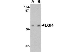 Western Blotting (WB) image for anti-Leucine-Rich Repeat LGI Family, Member 4 (LGI4) (Middle Region) antibody (ABIN1030984)