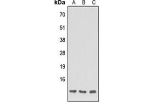 Western blot analysis of Apolipoprotein C1 expression in HEK293T (A), NS-1 (B), H9C2 (C) whole cell lysates. (APOC1 antibody  (Center))