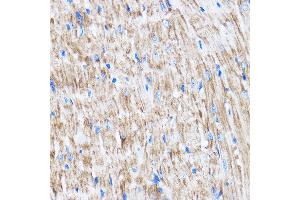Immunohistochemistry (IHC) image for anti-LATS, Large Tumor Suppressor, Homolog 2 (Drosophila) (LATS2) (AA 1-100) antibody (ABIN7268192)