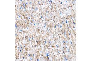 Immunohistochemistry of paraffin-embedded Mouse heart using L Rabbit pAb (ABIN7268192) at dilution of 1:100 (40x lens). (LATS2 antibody  (AA 1-100))