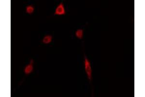 ABIN6274143 staining HepG2 cells by IF/ICC. (TOP3B antibody  (C-Term))