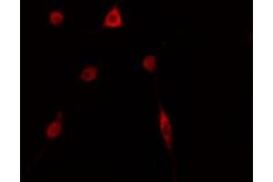 ABIN6274143 staining HepG2 cells by IF/ICC.