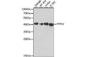 Western blot analysis of extracts of various cell lines using PTPN2 Polyclonal Antibody at dilution of 1:1000. (PTPN2 antibody)