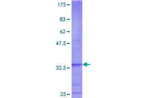 LASS5 Protein (AA 63-147) (GST tag)