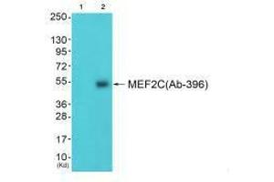Western blot analysis of extracts from 3T3 cells (Lane 2), using MEF2C (Ab-396) antiobdy. (MEF2C antibody  (Ser396))