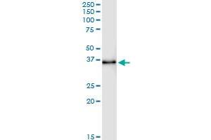 Immunoprecipitation of STX11 transfected lysate using anti-STX11 MaxPab rabbit polyclonal antibody and Protein A Magnetic Bead , and immunoblotted with STX11 purified MaxPab mouse polyclonal antibody (B01P) . (Syntaxin 11 antibody  (AA 1-287))