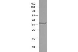 Western Blotting (WB) image for Netrin G1 (NTNG1) (AA 137-256) protein (His-IF2DI Tag) (ABIN7282525) (Netrin G1 Protein (NTNG1) (AA 137-256) (His-IF2DI Tag))