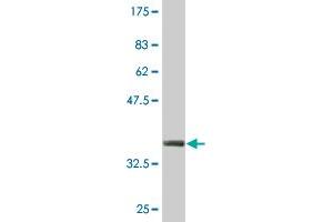 Western Blot detection against Immunogen (36. (ZSCAN16 antibody  (AA 132-230))