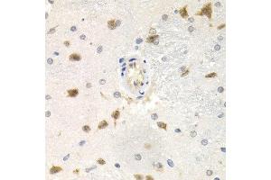 Immunohistochemistry of paraffin-embedded rat brain using CDC25A antibody at dilution of 1:200 (400x lens). (CDC25A antibody)