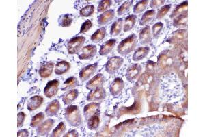 IHC analysis of Flt3 / CD135 using anti-Flt3 / CD135 antibody . (FLT3 antibody  (AA 62-295))