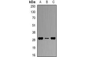 Western blot analysis of HLA-DPB1 expression in THP1 (A), mouse spleen (B), mouse liver (C) whole cell lysates.