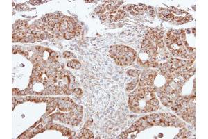 IHC-P Image Immunohistochemical analysis of paraffin-embedded NCI-N87 xenograft, using ACADM, antibody at 1:500 dilution. (Medium-Chain Specific Acyl-CoA Dehydrogenase, Mitochondrial (Center) antibody)
