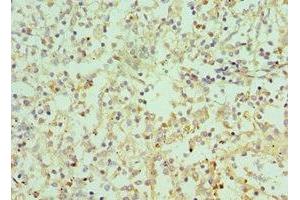 Immunohistochemistry of paraffin-embedded human spleen tissue using ABIN7156941 at dilution of 1:100 (IL-9 antibody  (AA 19-144))