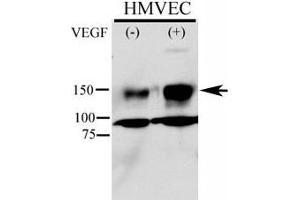 Phospho-KDR antibody used in western blot to detect phosphorylated KDR/FLK1 in HMVEC lysate.