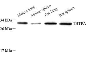 Western blot analysis of THTPA (ABIN7075879),at dilution of 1: 800 (THTPA antibody)