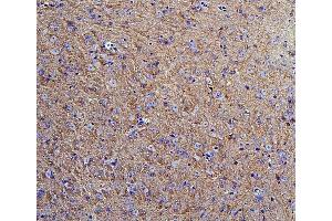IHC analysis of Hexokinase 1/HK1 using anti-Hexokinase 1/HK1 antibody (ABIN7600260). (Hexokinase 1 antibody  (AA 17-323))