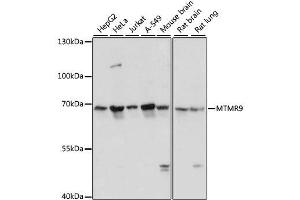 Western blot analysis of extracts of various cell lines, using MTMR9 antibody. (MTMR9 antibody  (AA 1-250))