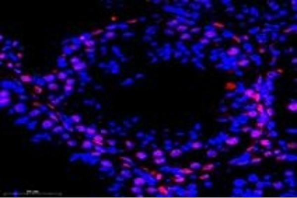 MED27 antibody
