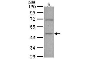 WB Image Sample (30 ug of whole cell lysate) A: A431 , 10% SDS PAGE antibody diluted at 1:1000 (ITPK1 antibody)