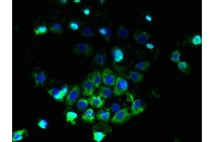 Immunofluorescent analysis of A431 cells using ABIN7144889 at dilution of 1:100 and Alexa Fluor 488-congugated AffiniPure Goat Anti-Rabbit IgG(H+L) (ABCB5 antibody  (AA 547-760))